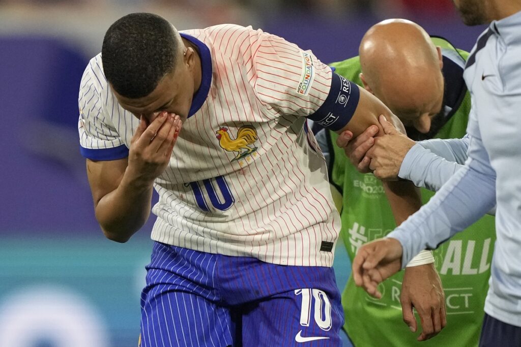 Kilijan Embape je slomio nos na utakmici Austrija - Francuska na Evropskom prvenstvu