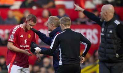 Manchester United's Matthijs de Ligt, left, receives medical treatment after sustaining an injury during the English Premier League soccer match between Manchester United and Brentford at Old Trafford stadium in Manchester, England, Saturday, Oct. 19, 2024. (AP Photo/Dave Thompson)